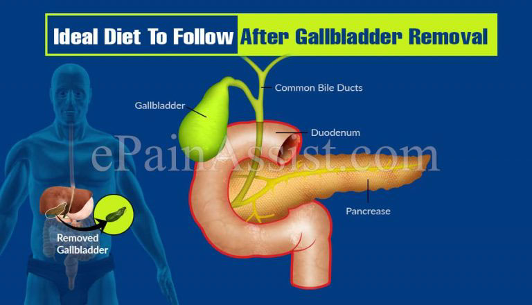 Ideal Diet To Follow After Gallbladder Removal