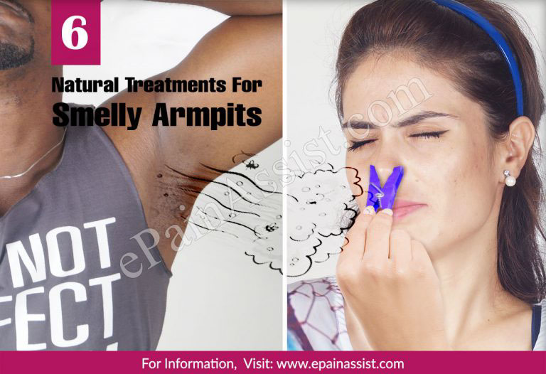 6 Natural Treatments For Smelly Armpits