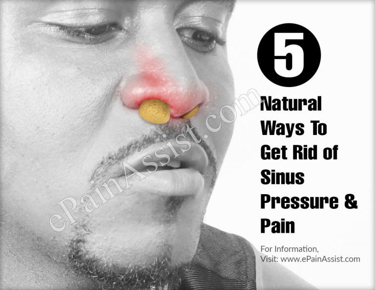 5 Natural Ways To Get Rid of Sinus Pressure & Pain