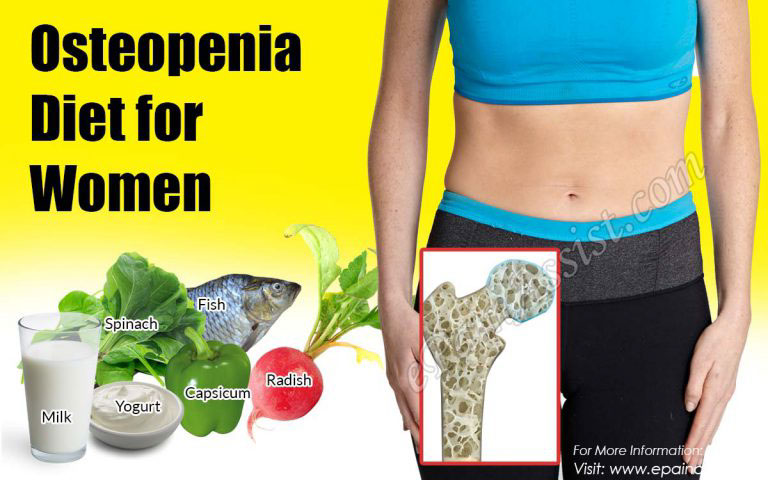 Osteopenia Diet for Women: Foods To Eat & Foods To Avoid