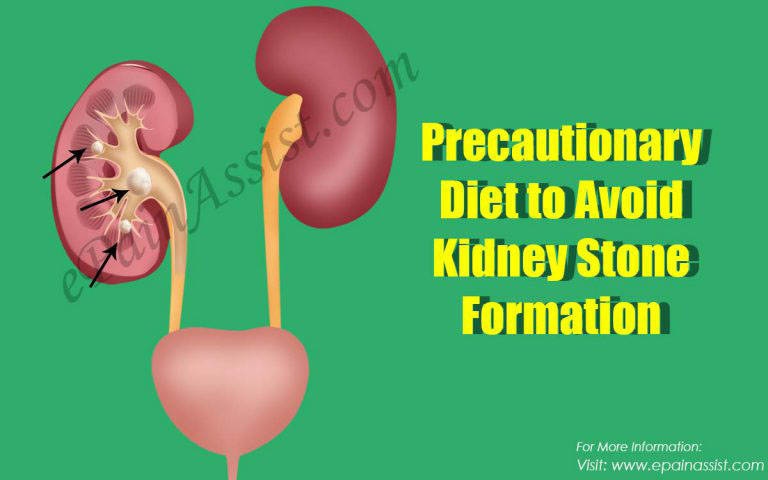 Precautionary Diet to Avoid Kidney Stone Formation