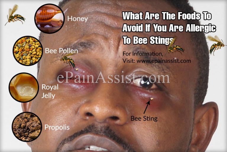 What Are The Foods To Avoid If You Are Allergic To Bee Stings