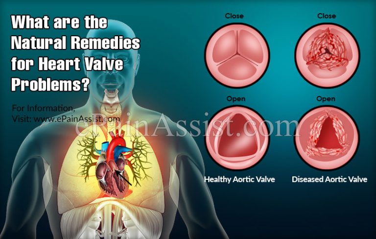 What are the Natural Remedies for Heart Valve Problems?