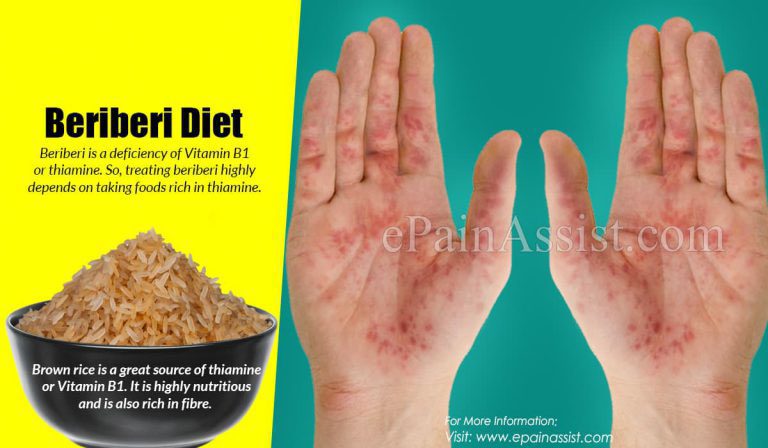 Beriberi Diet: Thiamine (Vitamin B1) Rich Foods Or Plant-Origin & Animal Origin For Beriberi