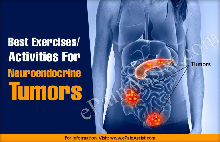 Best Exercises/Activities For Neuroendocrine Tumors