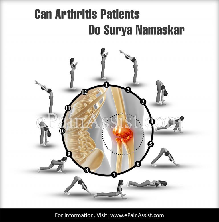 Can Arthritis Patients Do Surya Namaskar