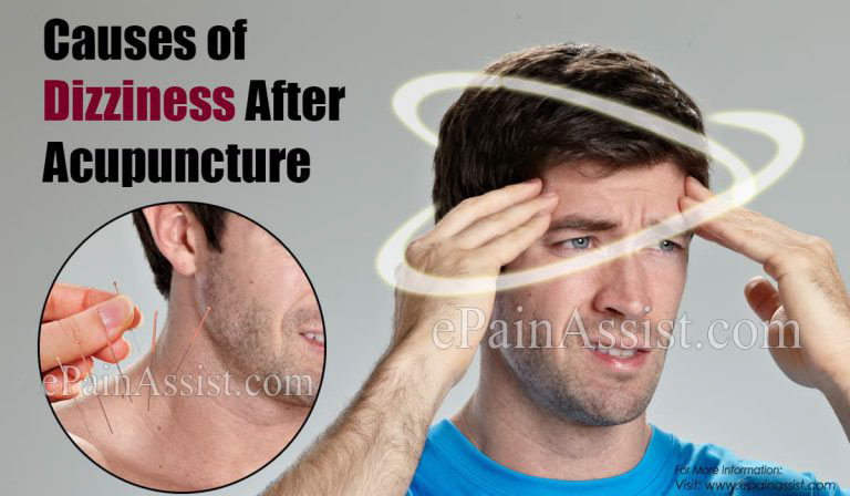 Causes of Dizziness After Acupuncture & Ways to Deal With it