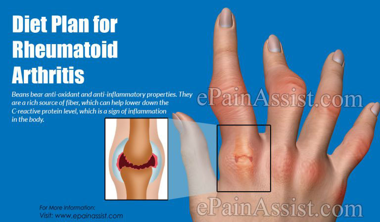 Diet Plan for Rheumatoid Arthritis