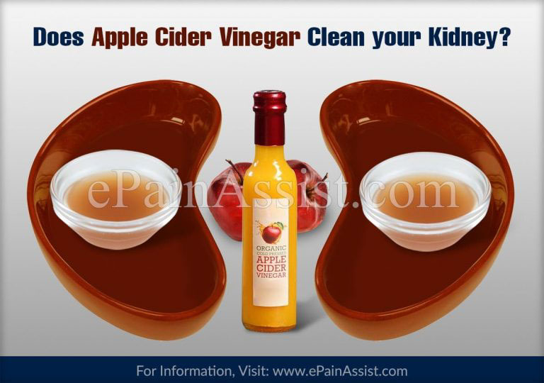 Does Apple Cider Vinegar Clean your Kidney?