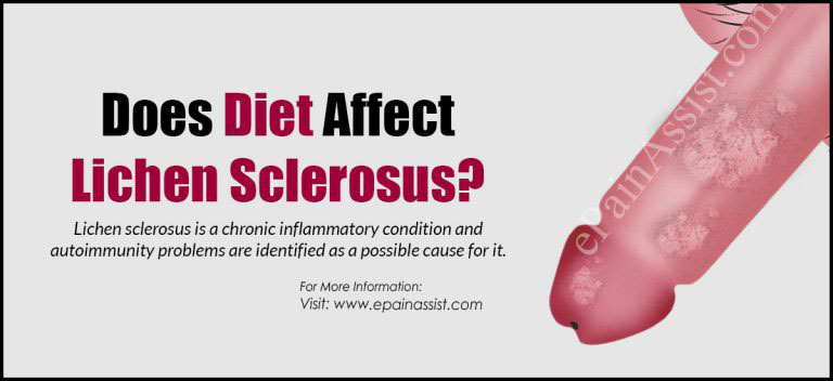 Does Diet Affect Lichen Sclerosus?