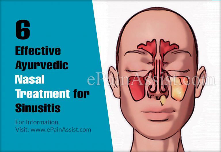 6 Effective Ayurvedic Nasal Treatment for Sinusitis