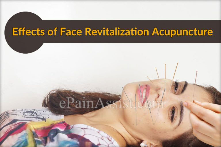 Face Revitalization Acupuncture