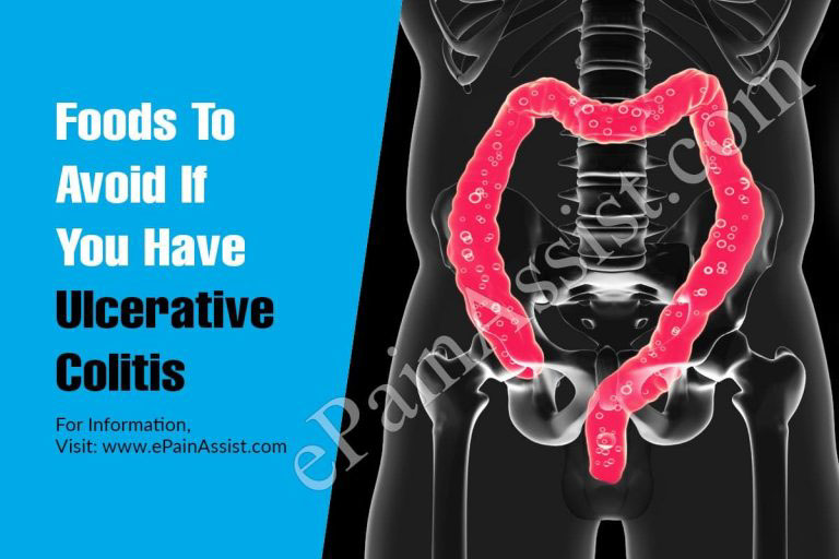 Foods To Avoid If You Have Ulcerative Colitis