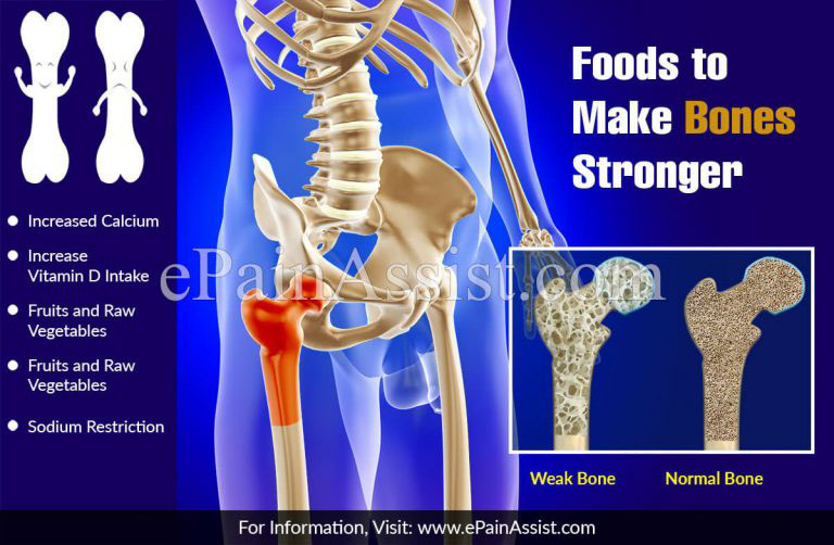 Foods to Make Bones Stronger