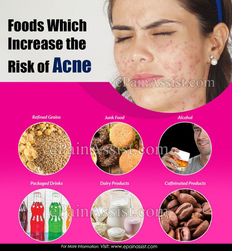 Foods Which Increase the Risk of Acne