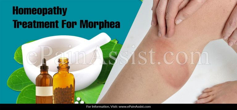 Homeopathy Treatment For Morphea