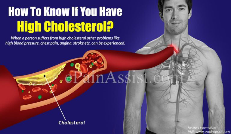 Causes of High Cholesterol & How To Know If You Have High Cholesterol?