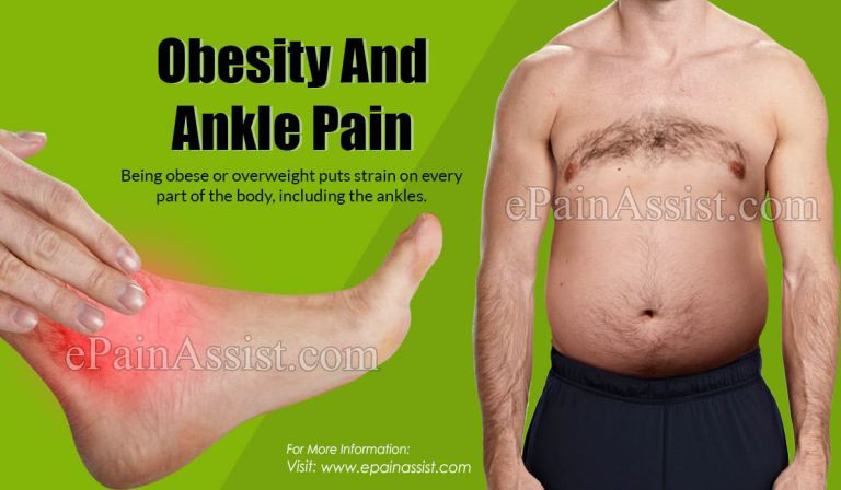 Obesity And Ankle Pain: What Is The Connection & How To Lose Weight To Manage Ankle Pain?