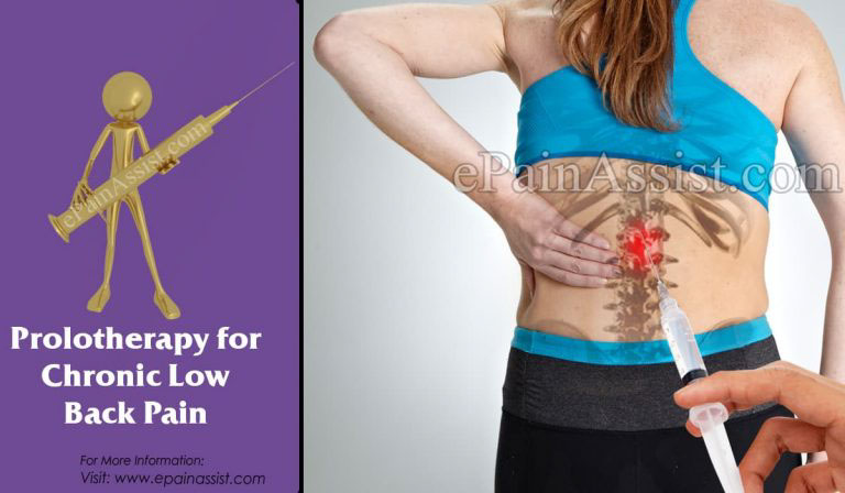 Prolotherapy for Chronic Low Back Pain: Outcome, Recovery, Risks, Complications