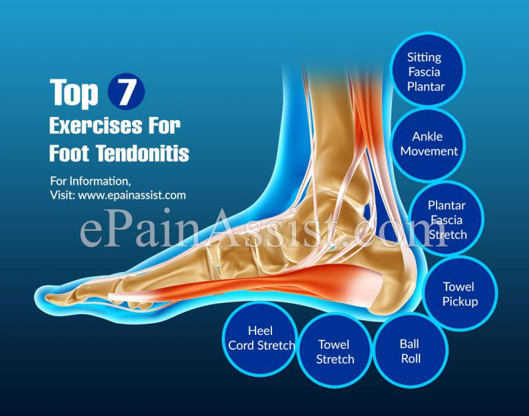 Top 7 Exercises For Foot Tendonitis