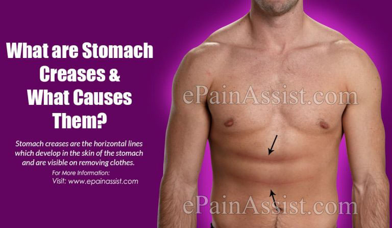 What are Stomach Creases, What Causes Them & How To Get Rid Of It?