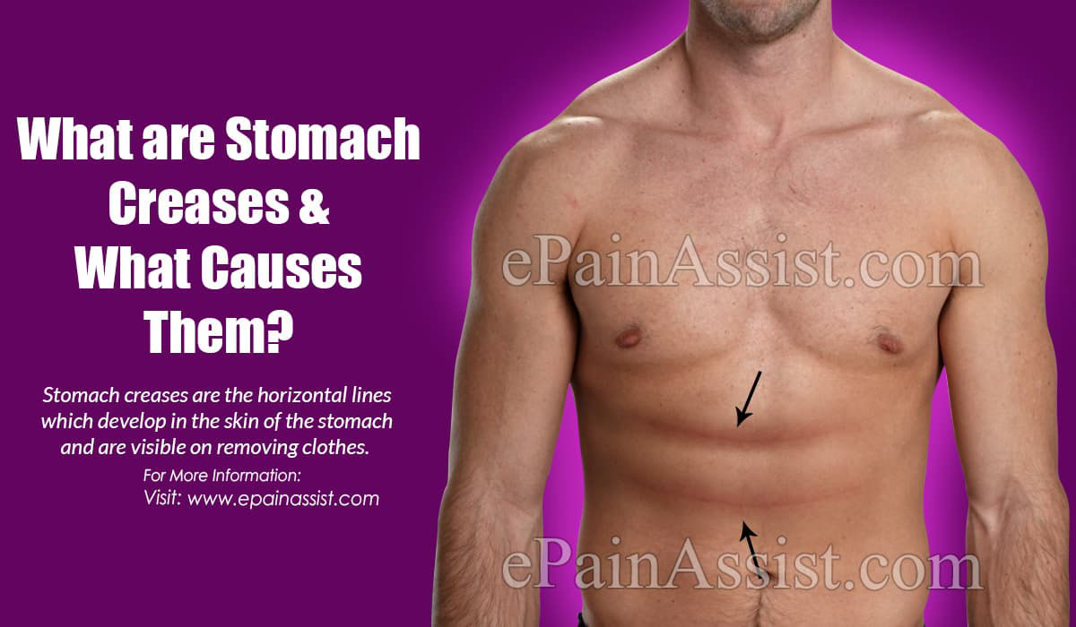 What are Stomach Creases ?