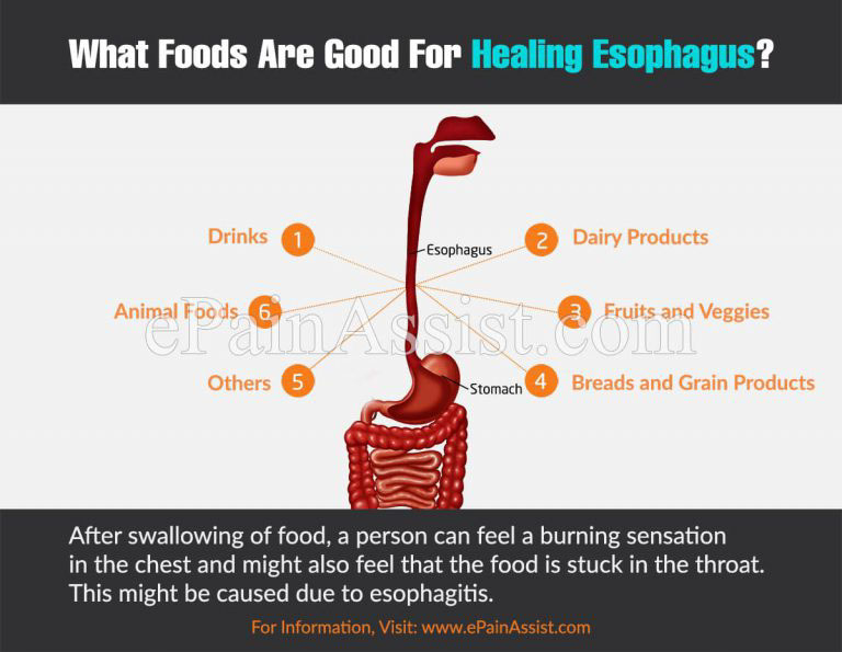 What Foods Are Good For Healing Esophagus?