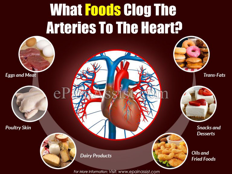What Foods Clog The Arteries To The Heart?