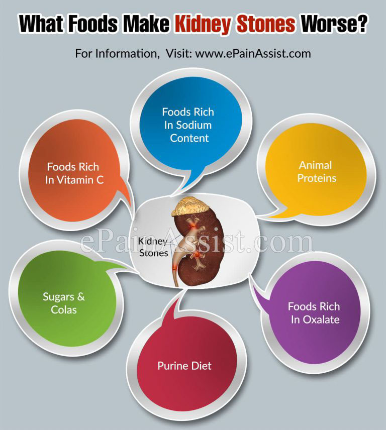 What Foods Make Kidney Stones Worse?