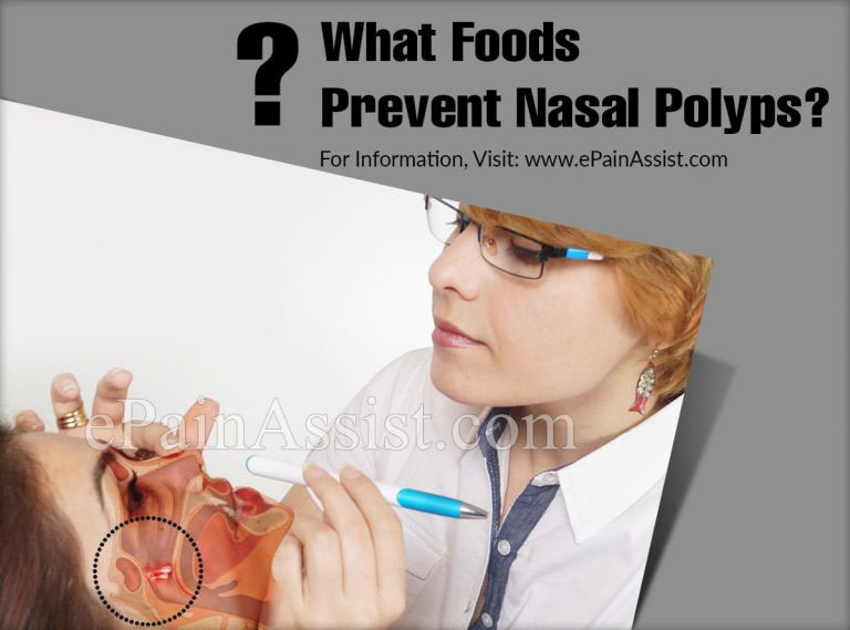 What Foods Prevent Nasal Polyps?