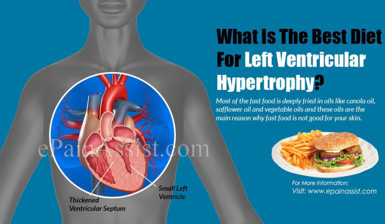 What Is The Best Diet For Left Ventricular Hypertrophy?
