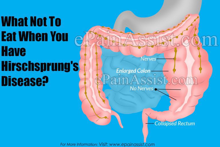 What Not To Eat When You Have Hirschsprung’s Disease?