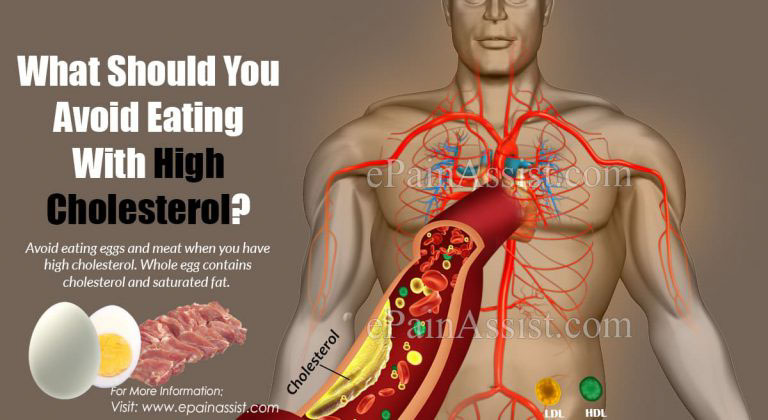 What Should You Avoid Eating With High Cholesterol?