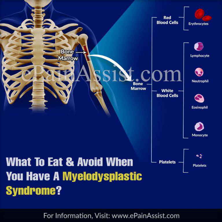 What To Eat & Avoid When You Have A Myelodysplastic Syndrome?