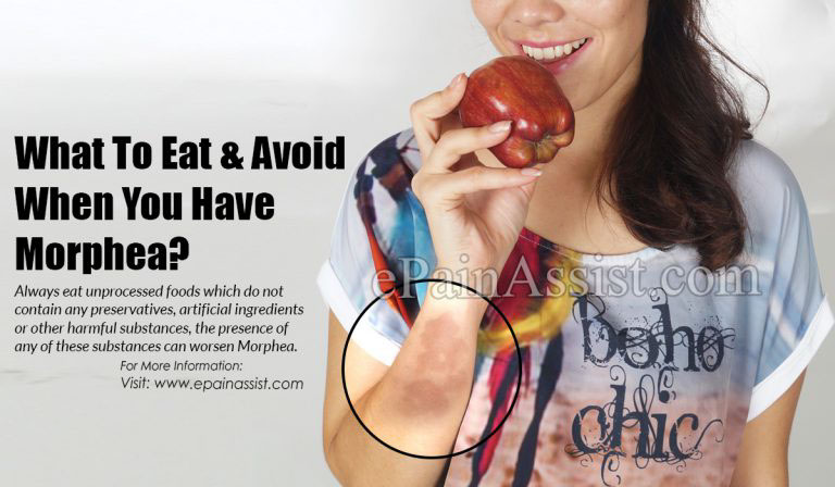 What To Eat & Avoid When You Have Morphea?