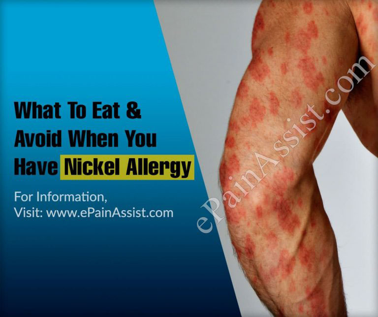 What To Eat & Avoid When You Have Nickel Allergy?