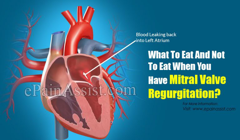 What To Eat And Not To Eat When You Have Mitral Valve Regurgitation?