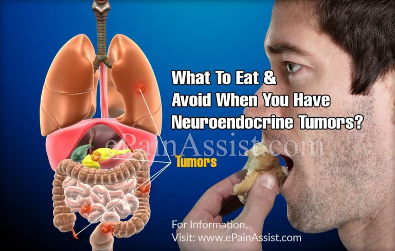 What To Eat & Avoid When You Have Neuroendocrine Tumors?