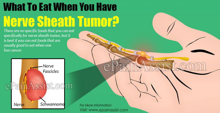 What To Eat When You Have Nerve Sheath Tumor?