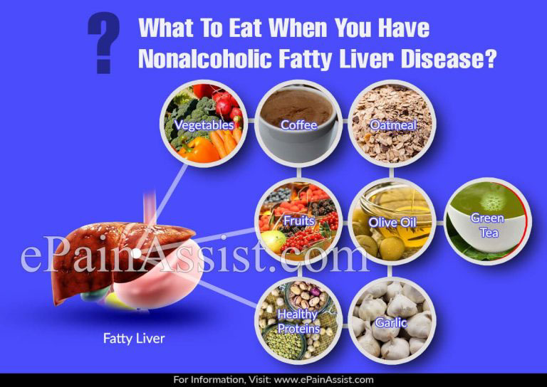 What To Eat & Avoid When You Have Nonalcoholic Fatty Liver Disease?