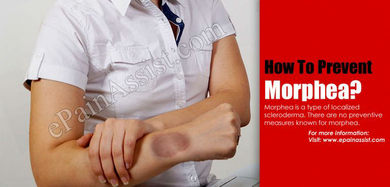 How To Prevent Morphea?