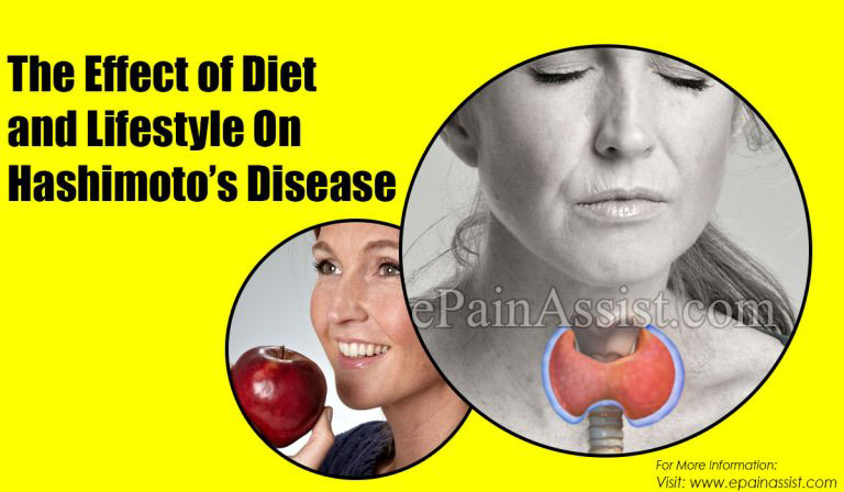 The Effect of Diet and Lifestyle On Hashimoto’s Disease