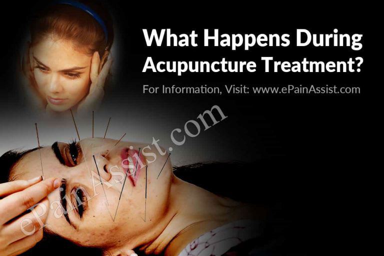Acupuncture: Mechanism of Action, What Happens During Acupuncture Treatment & Its Efficacy