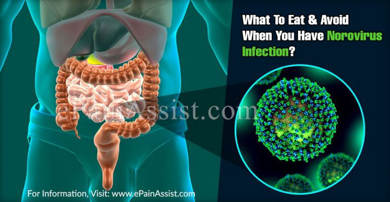 What To Eat & Avoid When You Have Norovirus Infection?