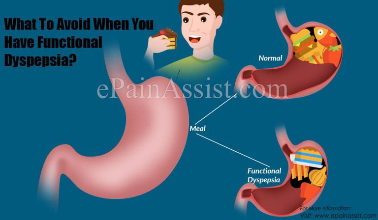 What To Eat & Avoid When You Have Functional Dyspepsia?