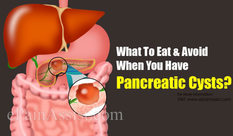 What To Eat & Avoid When You Have Pancreatic Cysts?