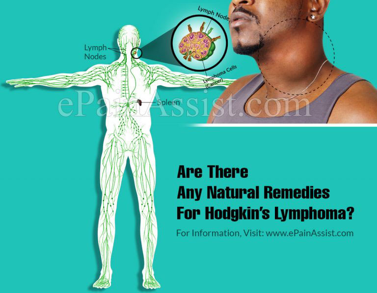 Are There Any Natural Remedies For Hodgkin’s Lymphoma?