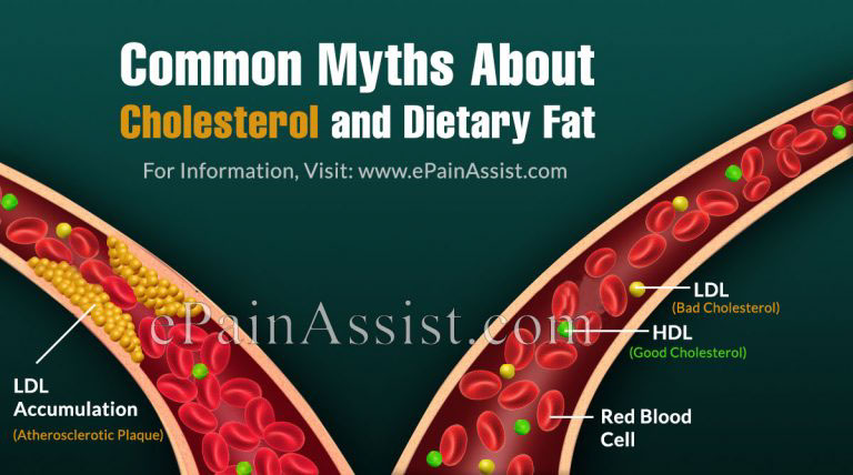 Common Myths About Cholesterol and Dietary Fat