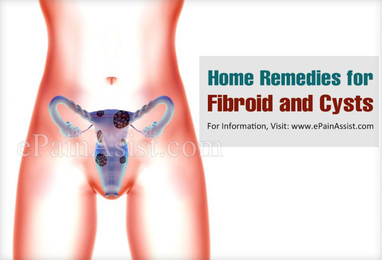 Home Remedies for Fibroid and Cysts