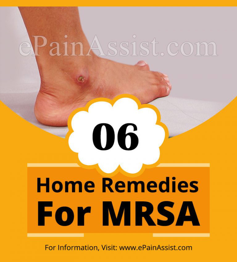 Home Remedies For MRSA